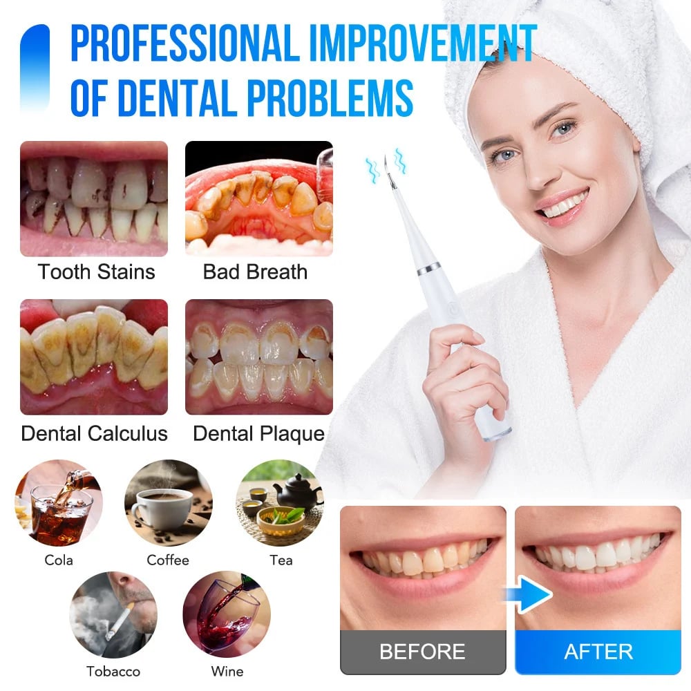 (👨⚕🦷Buy 2 Free Shipping)Electric tooth cleaning instrument -Teeth Cleaner