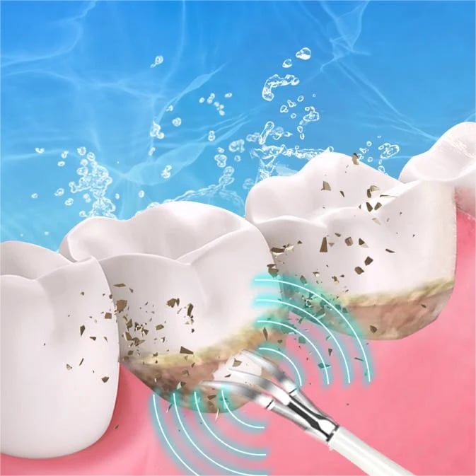 (👨⚕🦷Buy 2 Free Shipping)Electric tooth cleaning instrument -Teeth Cleaner