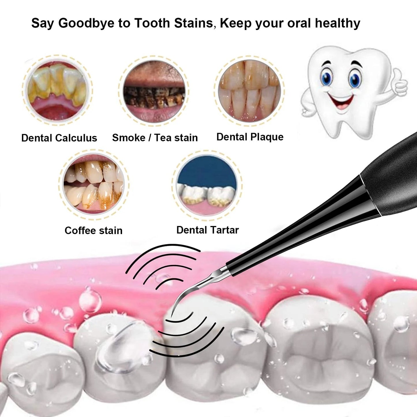 (👨⚕🦷Buy 2 Free Shipping)Electric tooth cleaning instrument -Teeth Cleaner